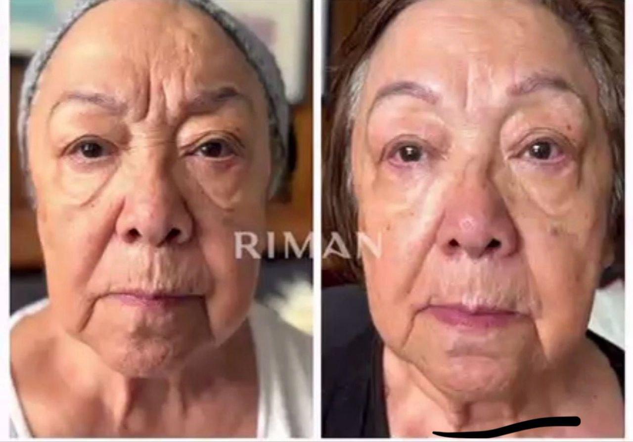 Resultado de producto 2