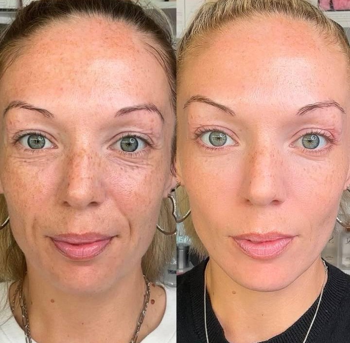 Resultado de producto 1